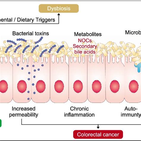 Dietary Compounds And The Role Of Microbiota In Colon Carcinogenesis