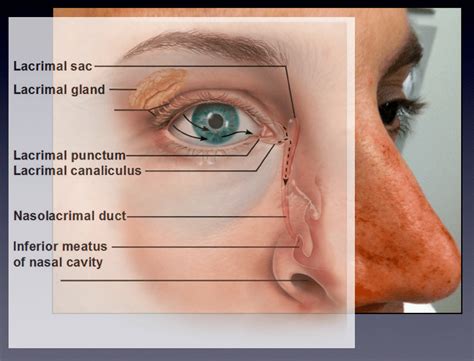 Lacerations Around The Eye Closing The Gap