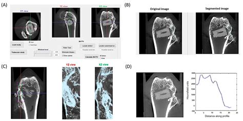 Biomolecules Free Full Text Osteogenic Potential Of A Biomaterial