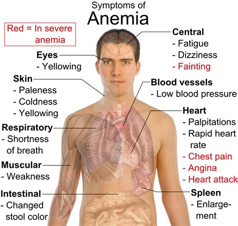 Types Of Anemia Medical Laboratories