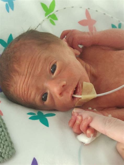 Baby Born Weighing Just Over 2lbs Defies The Odds After Six Weeks In