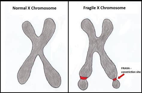 Filefragile X Chromosome Embryology