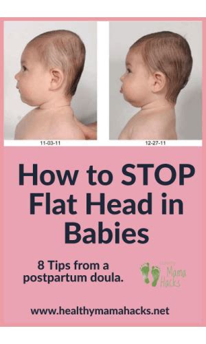 Plagiocephaly How To Prevent Flat Head In Babies Healthy Mama Hacks