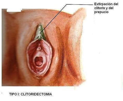 Mutilacion De Clitoris Telegraph