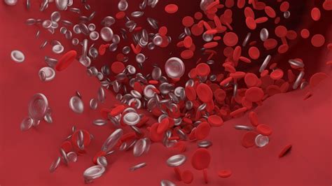 Researchers Unravel That Why Patients Develop Life Threatening Blood Clots