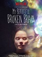 My Beautiful Broken Brain - Película 2014 - SensaCine.com