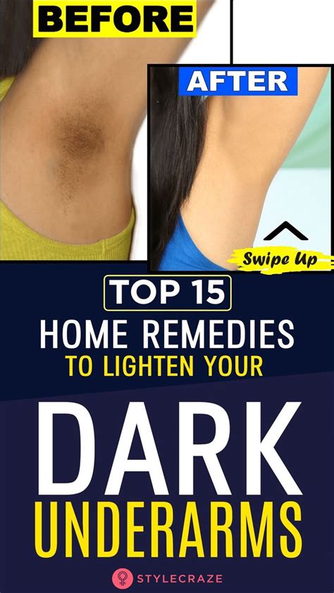 Top 15 Home Remedies To Lighten Your Dark Underarms Dark Underarms