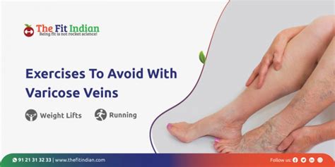 5 Effective And Amazing Exercises For Varicose Veins