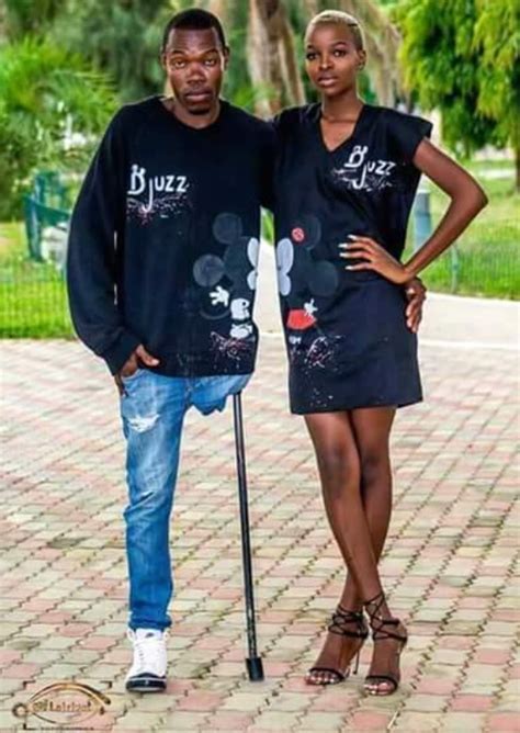 Check Out These Stunning Pre Wedding Photos Of Two Amputees