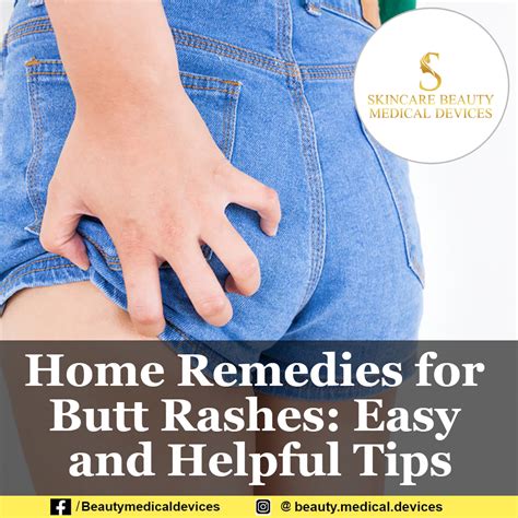 Home Remedies For Butt Rashes Easy And Helpful Tips