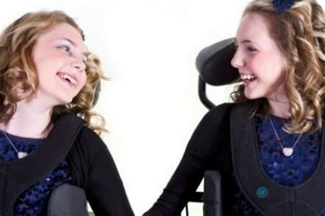 Twins With Worlds Rarest Medical Condition Celebrate 18th Birthdays