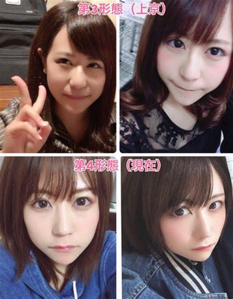 Foto Transformasi Oplas Gadis Jepang Ini Bikin Netizen Heboh Gaes
