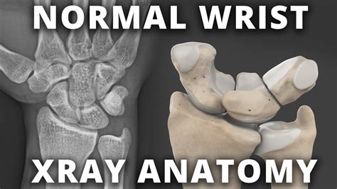 Normal Wrist Xray Radiographic Anatomy Tutorial Youtube
