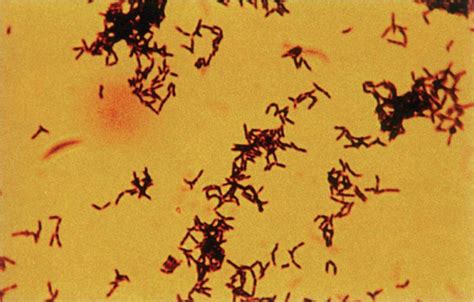 28 Actinomyces And Nocardia Basicmedical Key