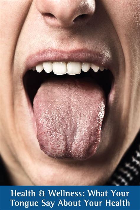 Q A What Does Your Tongue Say About Your Health