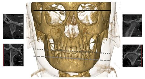 Jia And The Temporomandibular Joint Diagnostic Challenges And Treatment