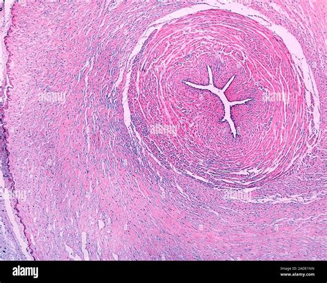 Micrografía De Luz De Un Cordón Umbilical Que Muestra De Izquierda A