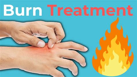 Burn Treatment Types Of Burns And How To Treat Them Youtube