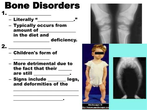Ppt Long Bone Structure Powerpoint Presentation Free