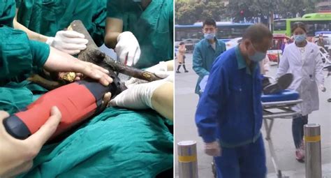 Man Impaled On Branches After Sixth Floor Fall In China