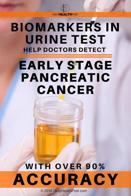 Biomarkers In Urine Test Help Detect Early Pancreatic Cancer