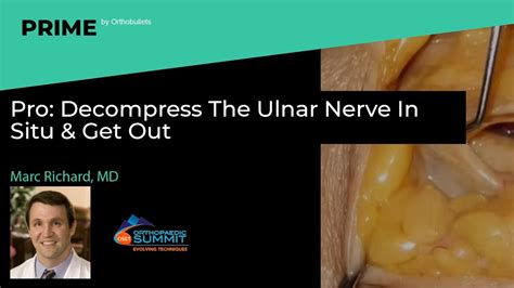 Pro Decompress The Ulnar Nerve In Situ And Get Out Marc Richard Md