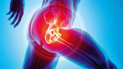 Blog How Can Stem Cell Therapy Help Prevent The Need For Hip Replacement
