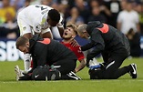 Harvey Elliott, jugador del Liverpool, sufre escalofriante fractura en ...