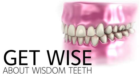 Normal Wisdom Teeth Growth