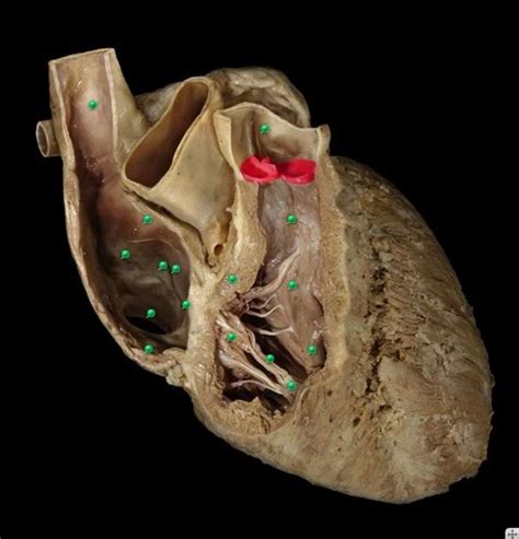 Pig Heart Dissection Flashcards Quizlet