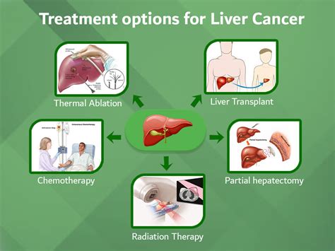 What Is The Cost Of Liver Cancer Treatment In India Clinicspots 2024