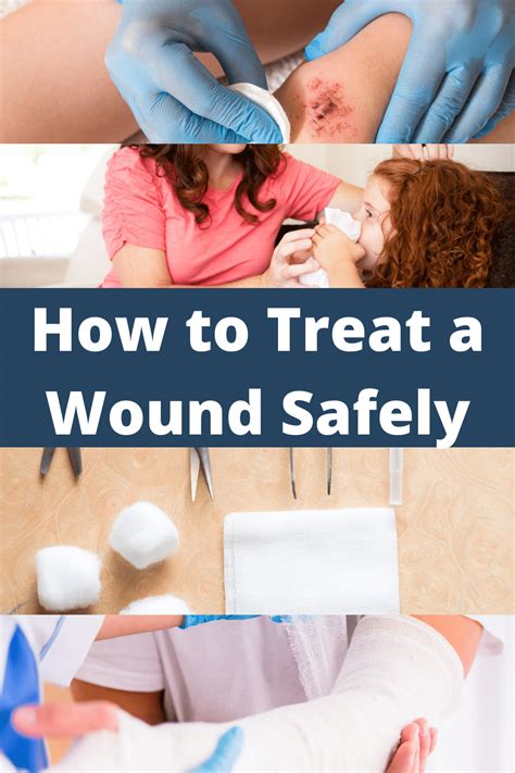 How To Treat A Wound Safely My Life With No Drugs