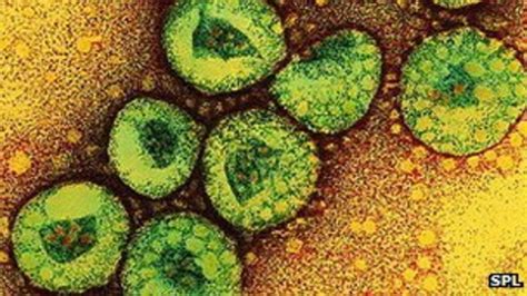 Second Uk Case Of Sars Like Coronavirus Identified Bbc News