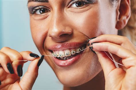 How To Manage Orthodontic Issues At Home