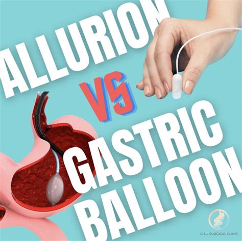 Allurion Elipse Balloon Vs Gastric Balloon Bariatric Clinic Singapore