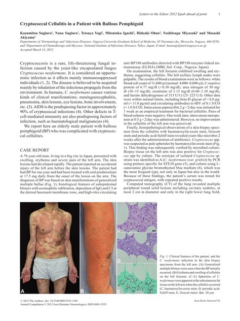 Pdf Cryptococcal Cellulitis In A Patient With Bullous Pemphigoid