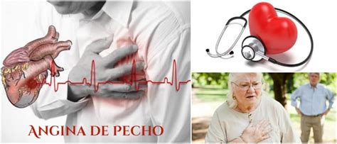 Angina De Pecho O Angina Estable Definici N S Ntomas Causas