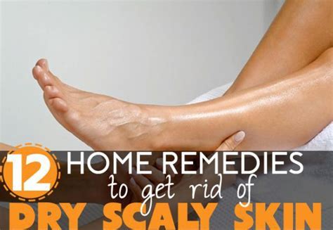 The 25 Best Dry Scaly Skin Ideas On Pinterest Feet Care Heel