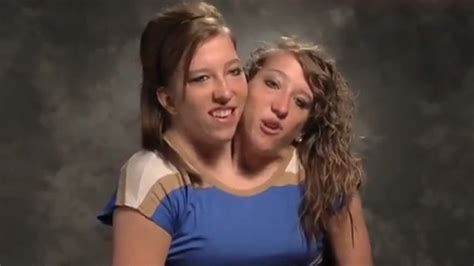 Conjoined Twins To Star In New Reality Tv Show Fox News