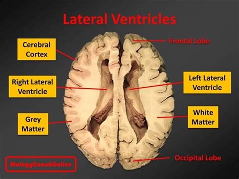 Last Weeks Mysteryanatomy Structure Was The Lateral Ventricle The
