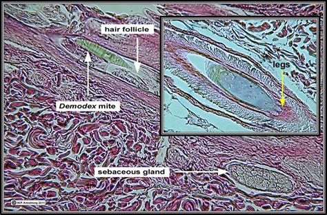 Prepared Microscope Slide From The Dermis Layer Of Human Skin Showing A