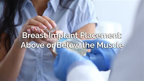 Breast Implant Placement Above Or Below The Muscle YouTube