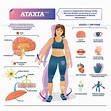 Ataxia disease medical vector illustration infographic | Ejercicio ...