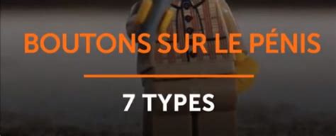 Boutons Sur Le P Nis Types Vid O Dailymotion