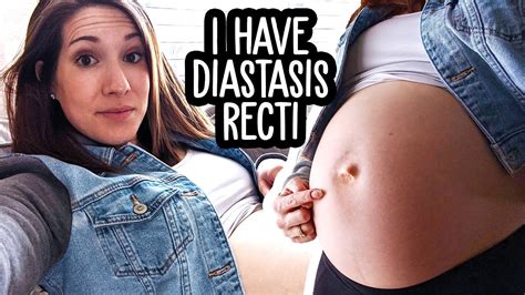 Whats Wrong With My Pregnant Belly Diastasis Recti Youtube