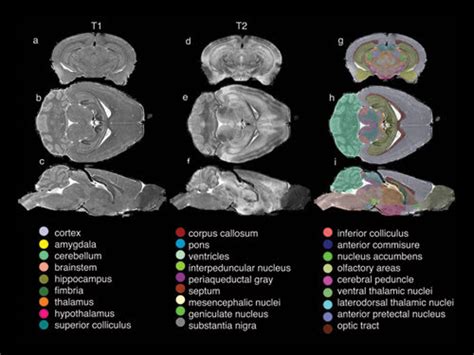 High Resolution Mri Method Generates Virtual Mouse Brains Sep 2007