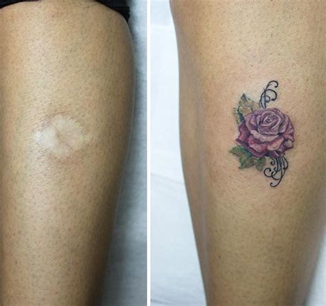 211 Amazing Tattoos That Turn Scars Into Works Of Art