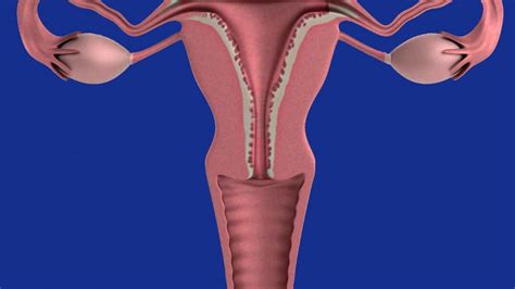 Endometrio Engrosado O Hiperplasia Endometrial Causas Y S Ntomas Hot