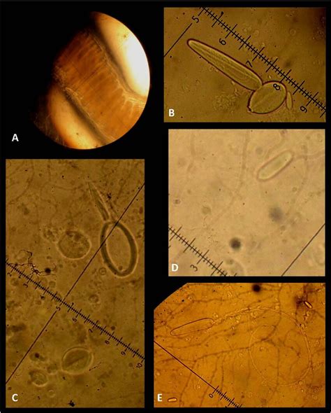 Nematocysts Of Chimaerus Palmatus Comb Nov A P Mastigophores Aligned