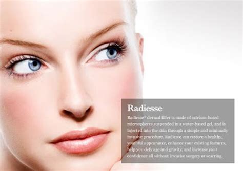 Facts You Need To Know About Radiesse
